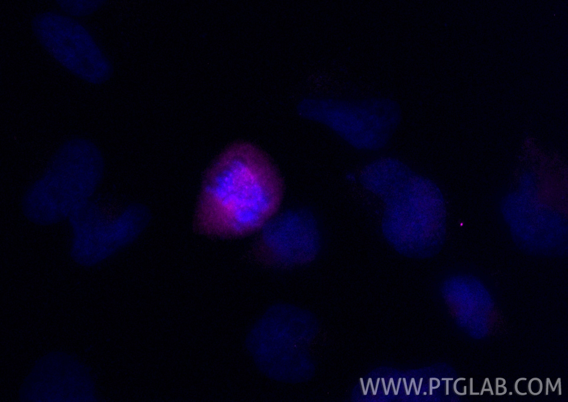 Immunofluorescence (IF) / fluorescent staining of HeLa cells using CoraLite® Plus 647-conjugated CENPF Recombinant an (CL647-84865-4)