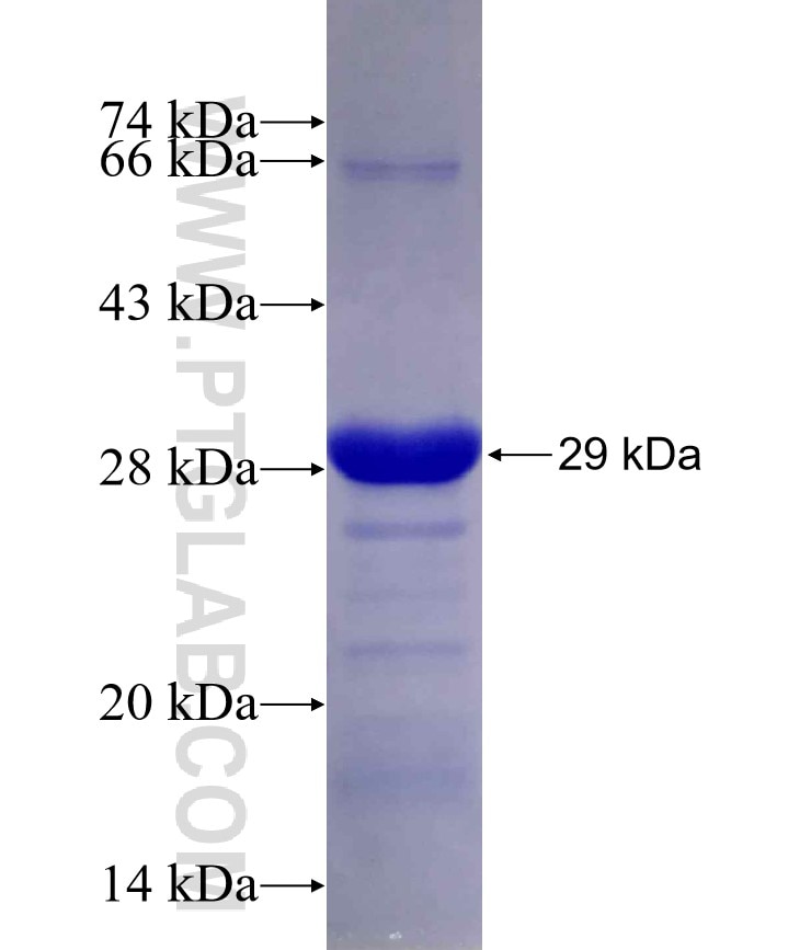 CENPF fusion protein Ag29688 SDS-PAGE