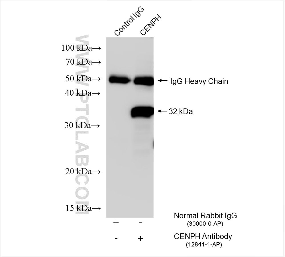 Immunoprecipitation (IP) experiment of HeLa cells using CENPH Polyclonal antibody (12841-1-AP)