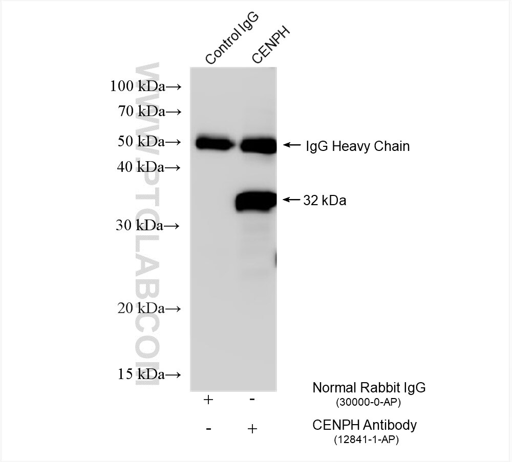 IP experiment of HeLa using 12841-1-AP