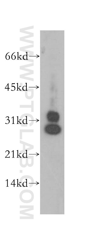 CENPH Polyclonal antibody