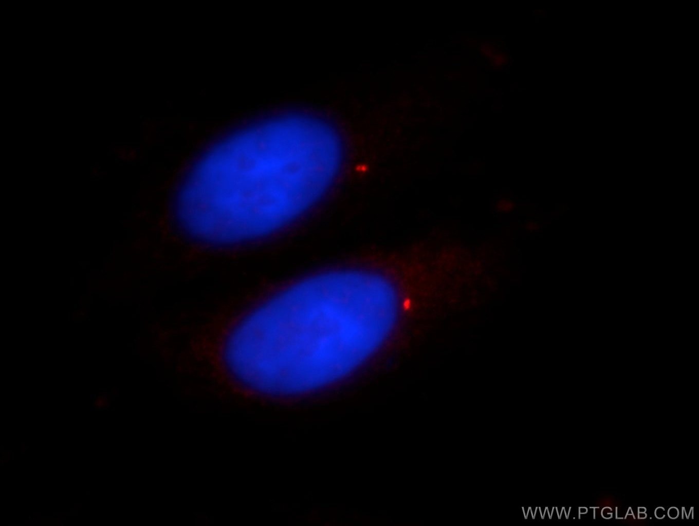 Immunofluorescence (IF) / fluorescent staining of HepG2 cells using CENPJ Polyclonal antibody (11517-1-AP)