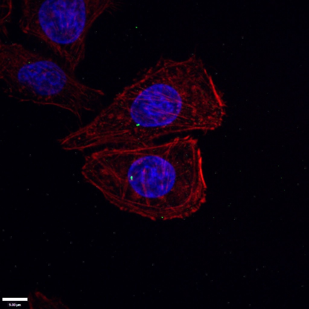 IF Staining of HepG2 using 11517-1-AP