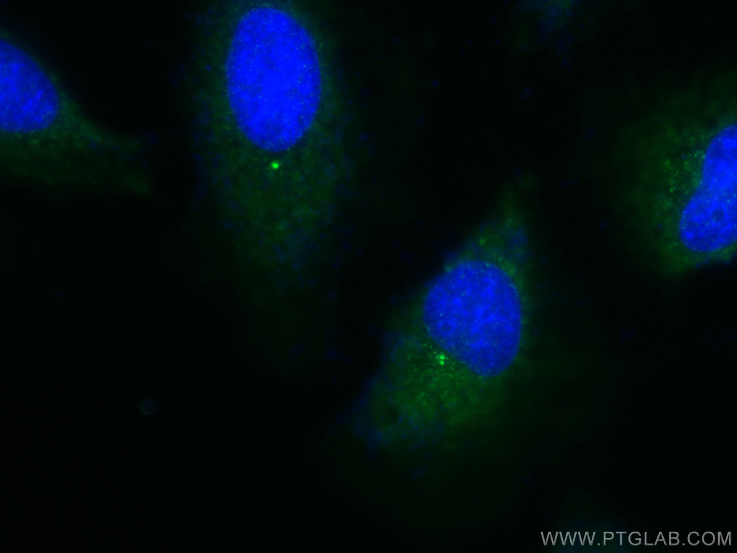 Immunofluorescence (IF) / fluorescent staining of HeLa cells using CENPJ Polyclonal antibody (11517-1-AP)