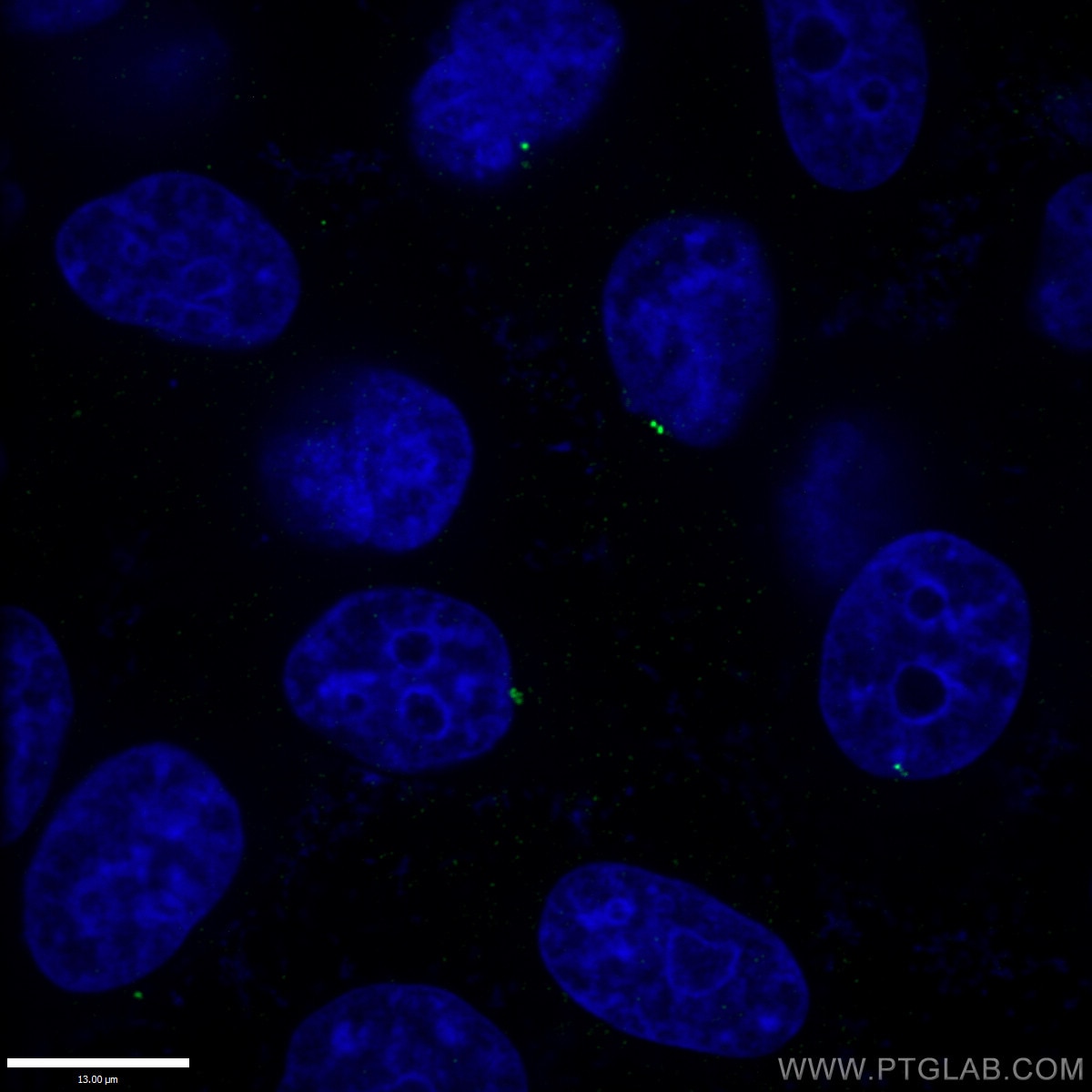 Immunofluorescence (IF) / fluorescent staining of HepG2 cells using CENPJ Polyclonal antibody (11517-1-AP)