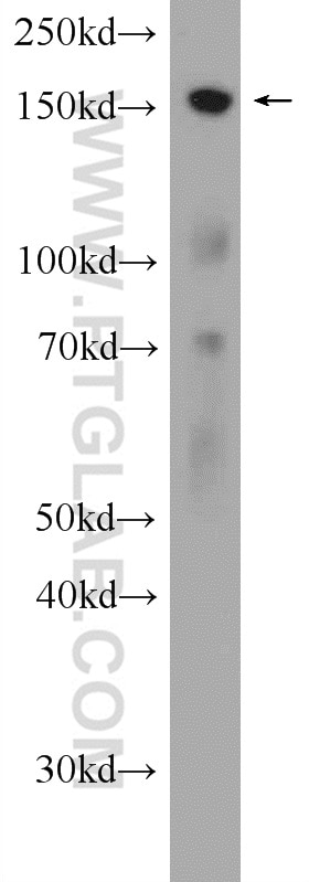 Western Blot (WB) analysis of mouse testis tissue using CENPJ Polyclonal antibody (11517-1-AP)