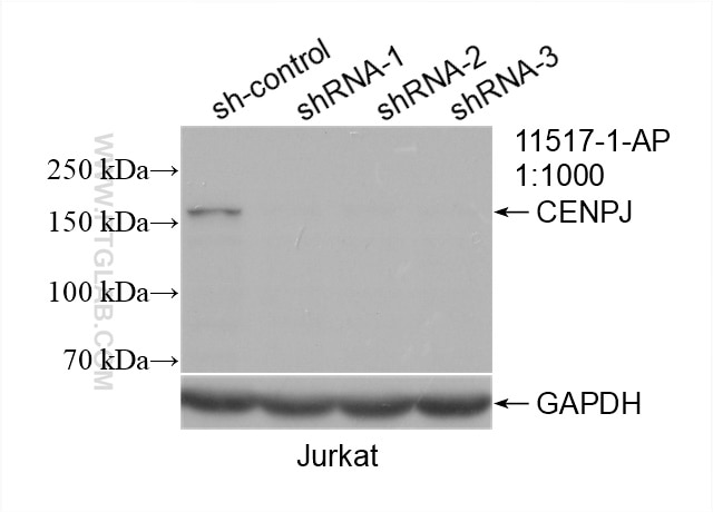 Western Blot (WB) analysis of Jurkat cells using CENPJ Polyclonal antibody (11517-1-AP)
