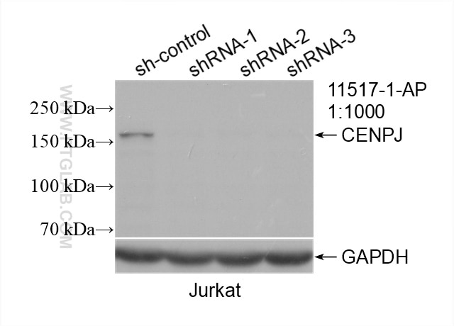 WB analysis of Jurkat using 11517-1-AP