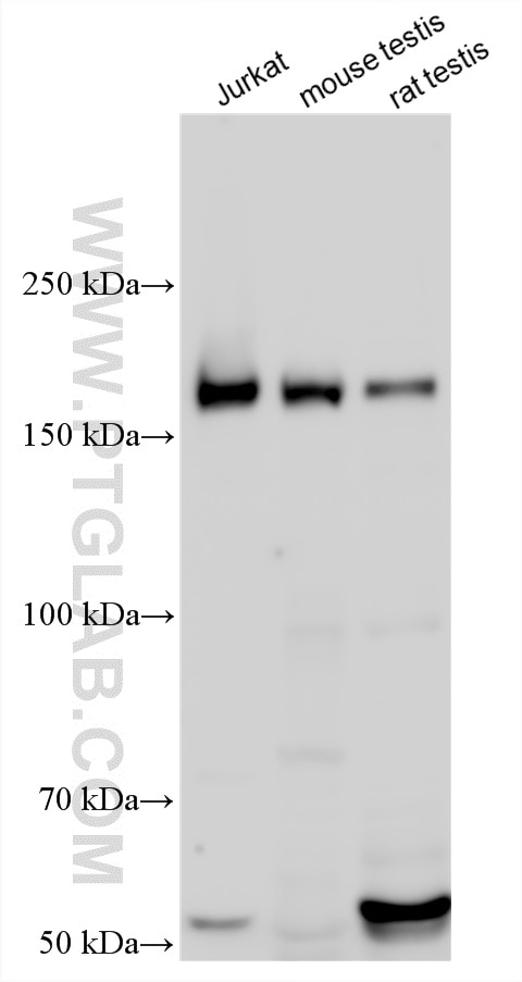 WB analysis using 11517-1-AP Western Blot (WB) analysis of various lysates using CENPJ Polyclonal antibody (11517-1-AP)