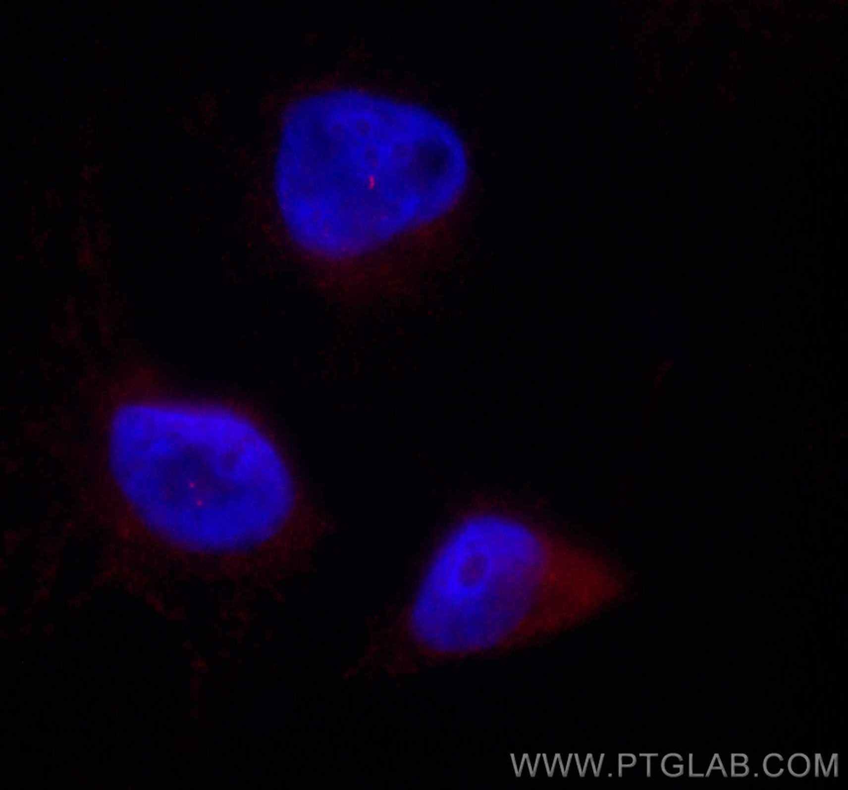 Immunofluorescence (IF) / fluorescent staining of HeLa cells using CoraLite®594-conjugated CENPJ Polyclonal antibody (CL594-11517)