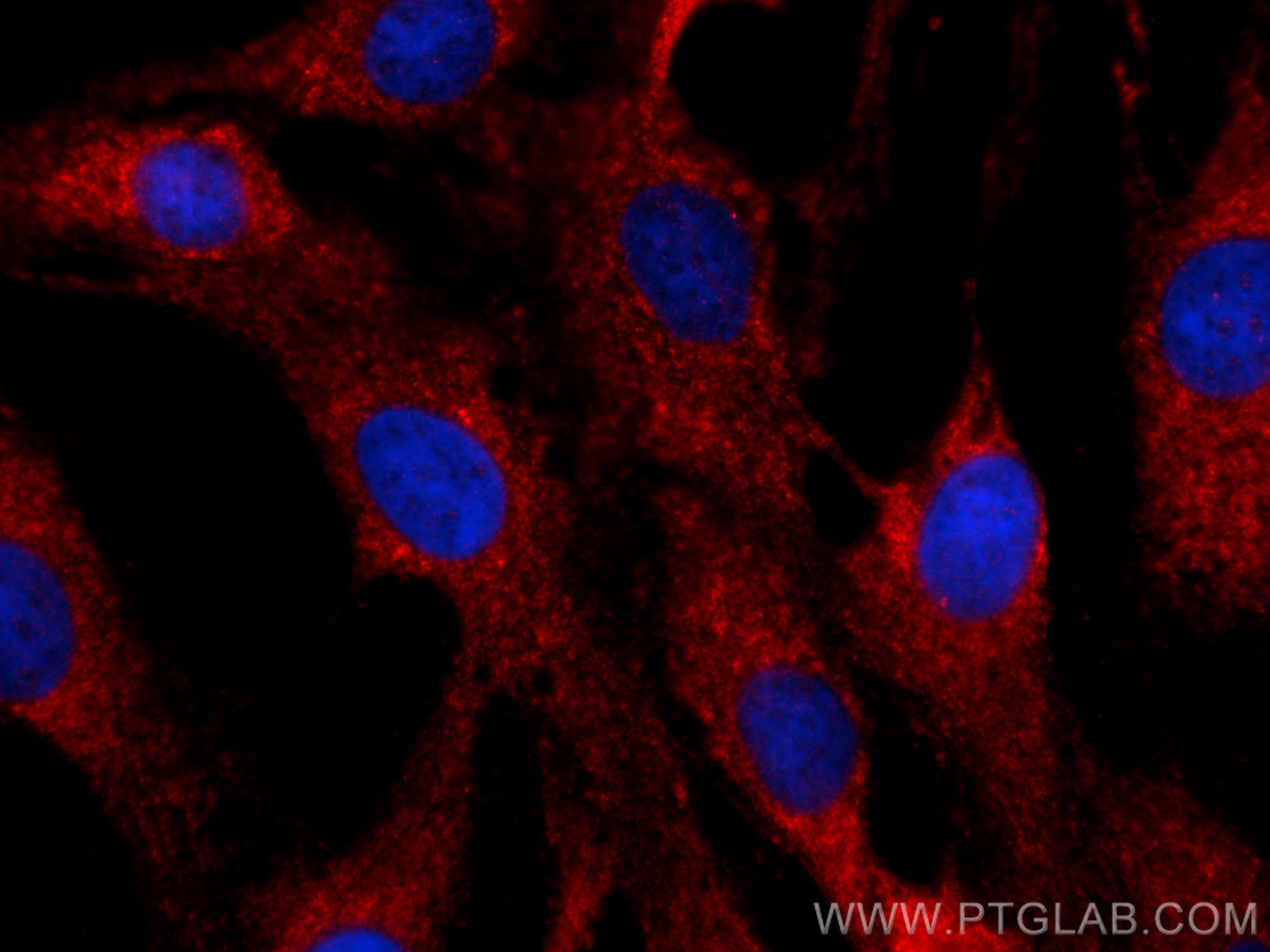 Immunofluorescence (IF) / fluorescent staining of MDCK cells using CoraLite®594-conjugated CENPJ Polyclonal antibody (CL594-11517)