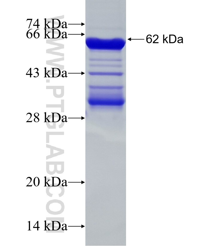 CENPJ fusion protein Ag2078 SDS-PAGE