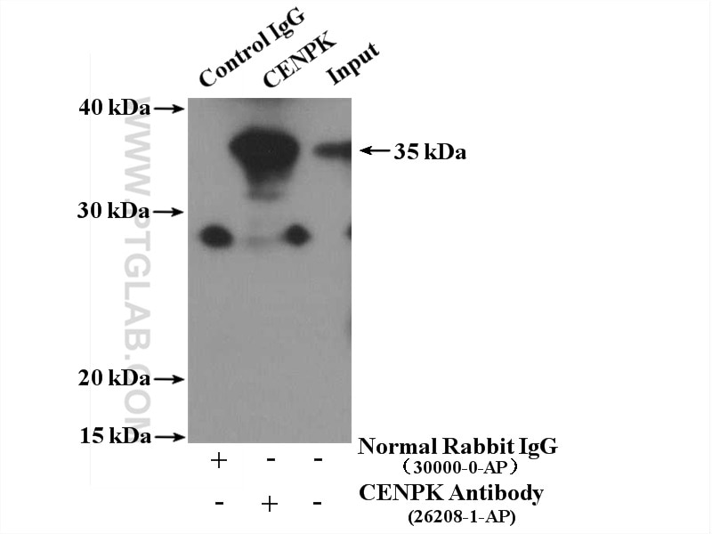Immunoprecipitation (IP) experiment of HeLa cells using CENPK Polyclonal antibody (26208-1-AP)