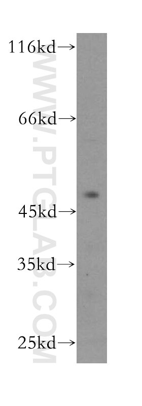 Western Blot (WB) analysis of PC-3 cells using CENPL Polyclonal antibody (17007-1-AP)