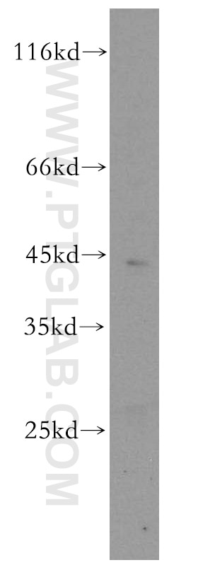 Western Blot (WB) analysis of Raji cells using CENPL Polyclonal antibody (17007-1-AP)