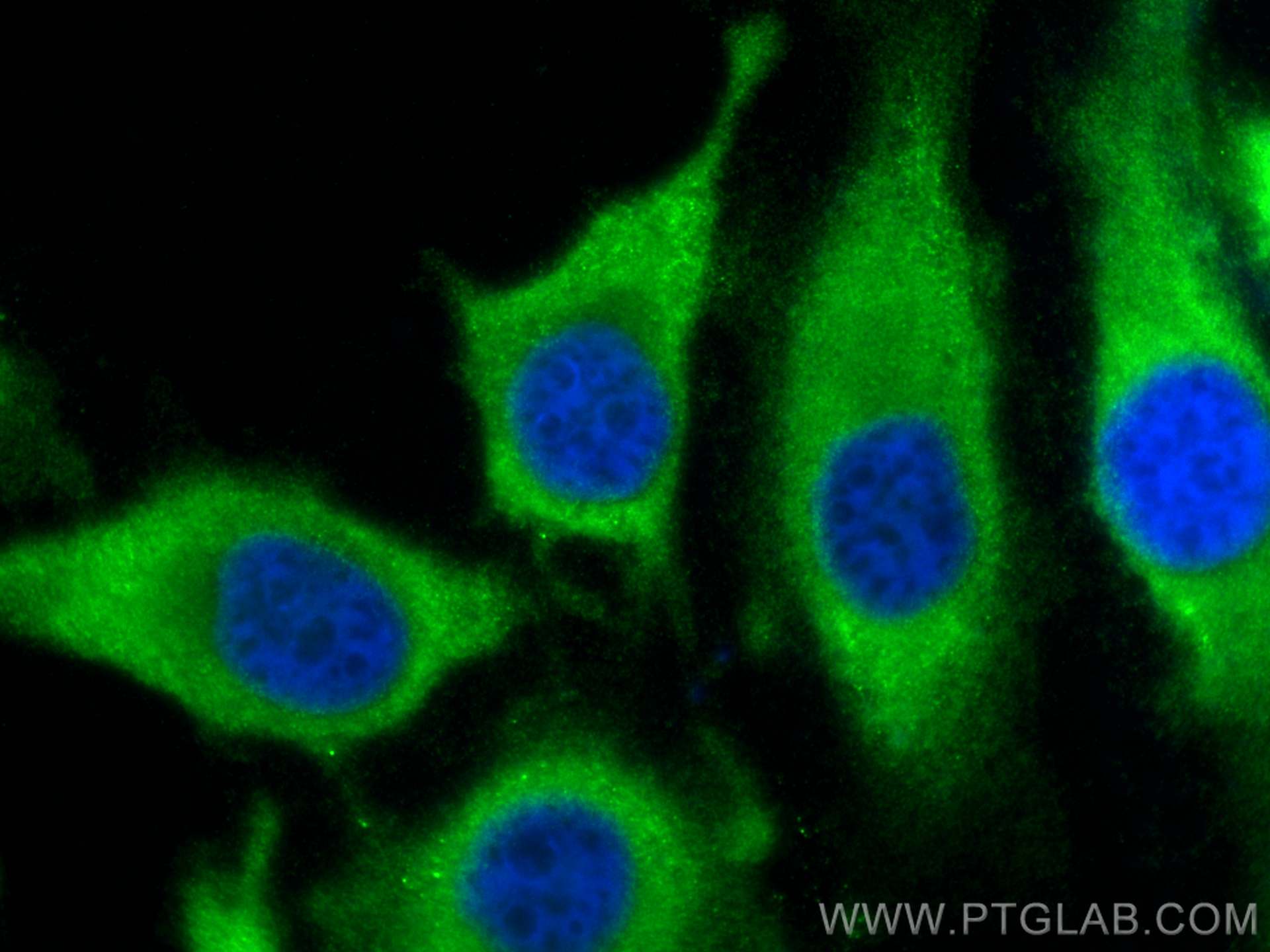 Immunofluorescence (IF) / fluorescent staining of HeLa cells using CENPM Polyclonal antibody (19840-1-AP)