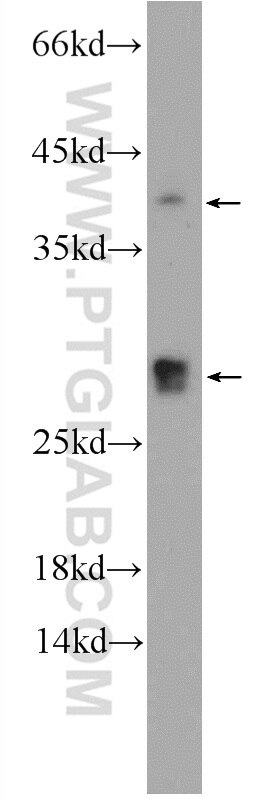 Western Blot (WB) analysis of MCF-7 cells using CENPN Polyclonal antibody (16751-1-AP)