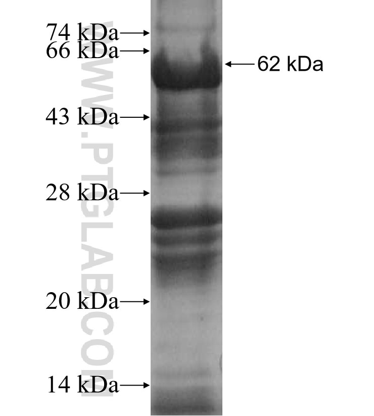 CENPN fusion protein Ag10219 SDS-PAGE