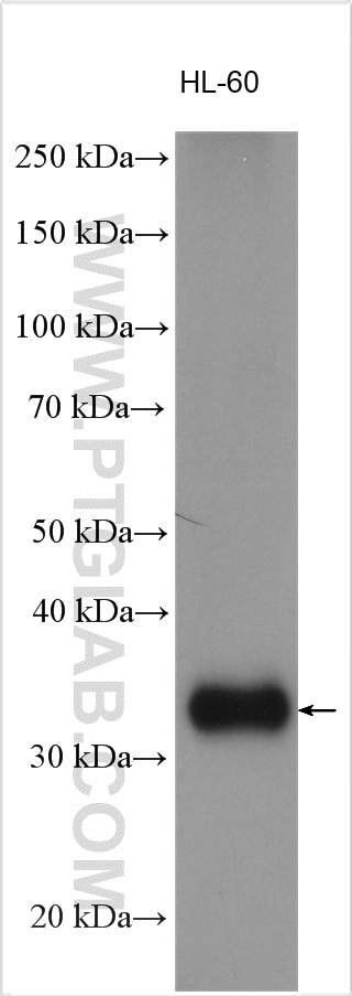Western Blot (WB) analysis of various lysates using CENPO Polyclonal antibody (20611-1-AP)