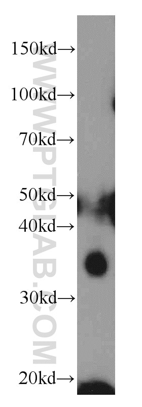 Western Blot (WB) analysis of mouse kidney tissue using CENPO Polyclonal antibody (20611-1-AP)