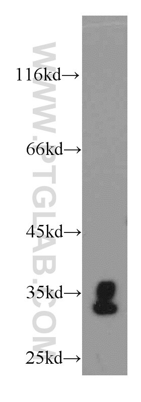 Western Blot (WB) analysis of mouse brain tissue using CENPO Polyclonal antibody (20611-1-AP)