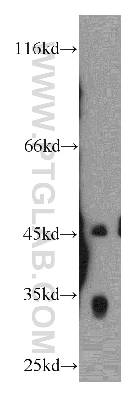 Western Blot (WB) analysis of HEK-293 cells using CENPO Polyclonal antibody (20611-1-AP)