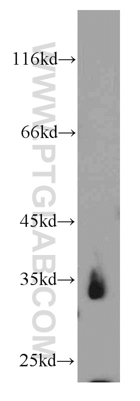 WB analysis of mouse ovary using 20611-1-AP