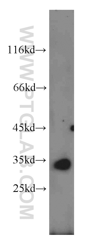 Western Blot (WB) analysis of mouse brain tissue using CENPO Polyclonal antibody (20611-1-AP)