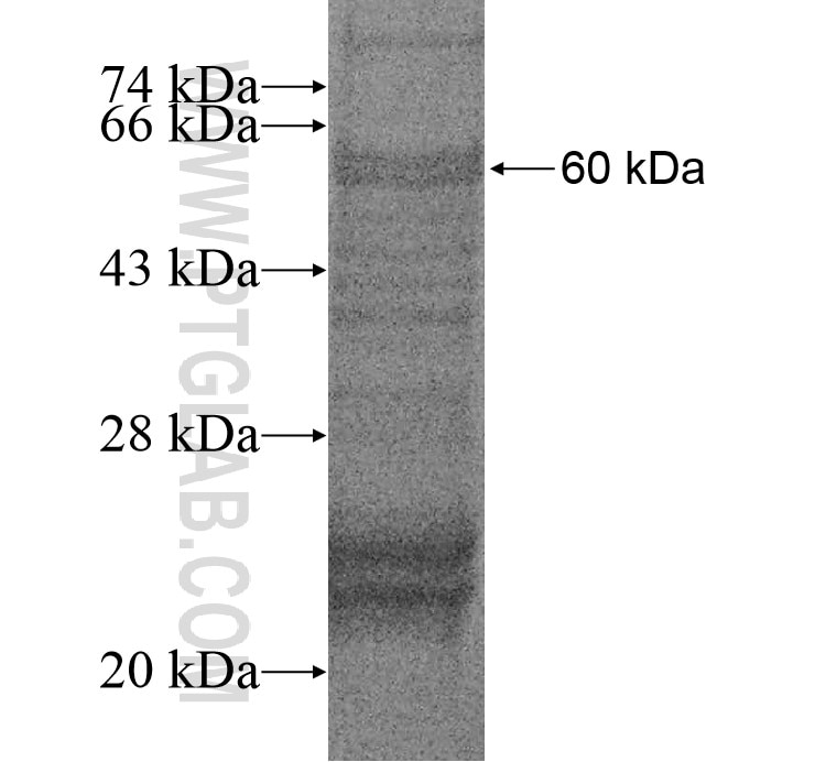 CENPO fusion protein Ag14619 SDS-PAGE