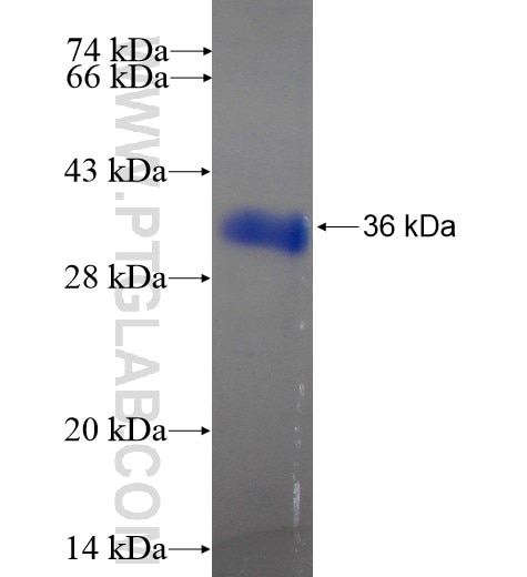 CENPO fusion protein Ag15640 SDS-PAGE