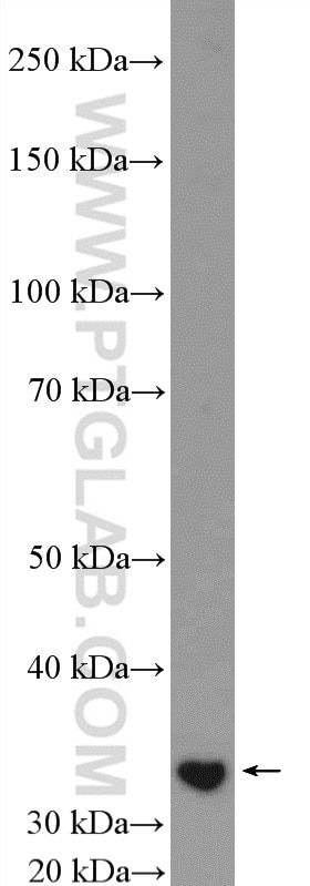 Western Blot (WB) analysis of HEK-293T cells using CENPP Polyclonal antibody (18096-1-AP)