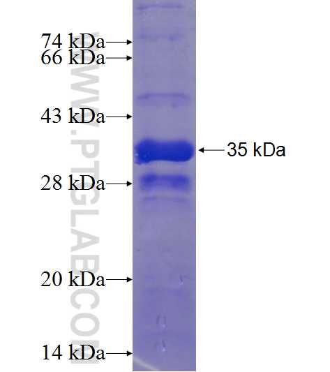 CENPP fusion protein Ag11865 SDS-PAGE