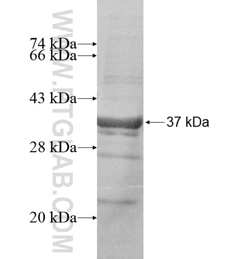 CENPQ fusion protein Ag10499 SDS-PAGE