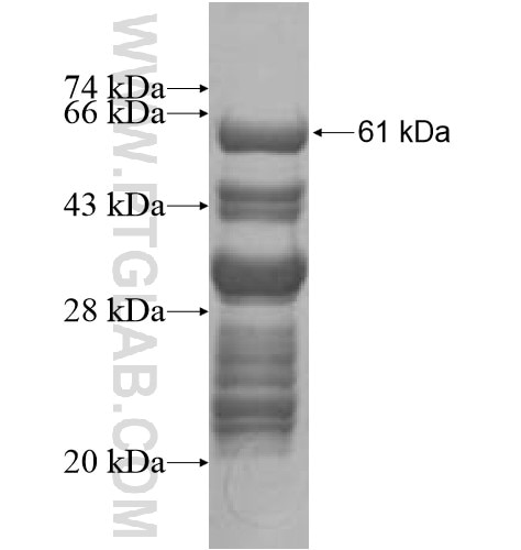 CENPQ fusion protein Ag10520 SDS-PAGE