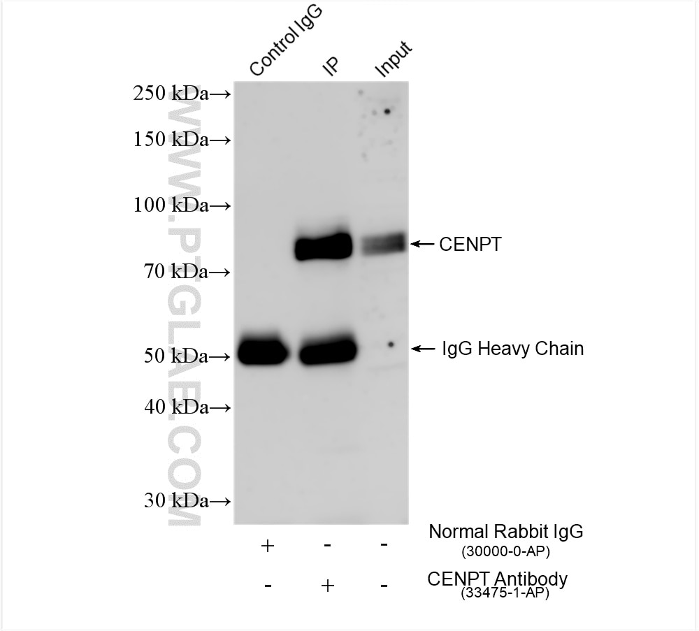 IP experiment of HEK-293T using 33475-1-AP Immunoprecipitation (IP) experiment of HEK-293T cells using CENPT Polyclonal antibody (33475-1-AP)