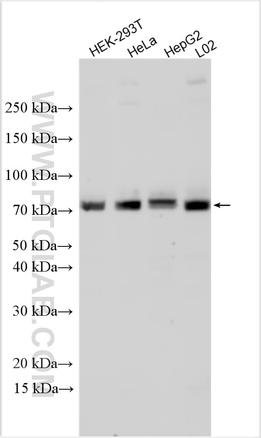 WB analysis using 33475-1-AP Western Blot (WB) analysis of various lysates using CENPT Polyclonal antibody (33475-1-AP)