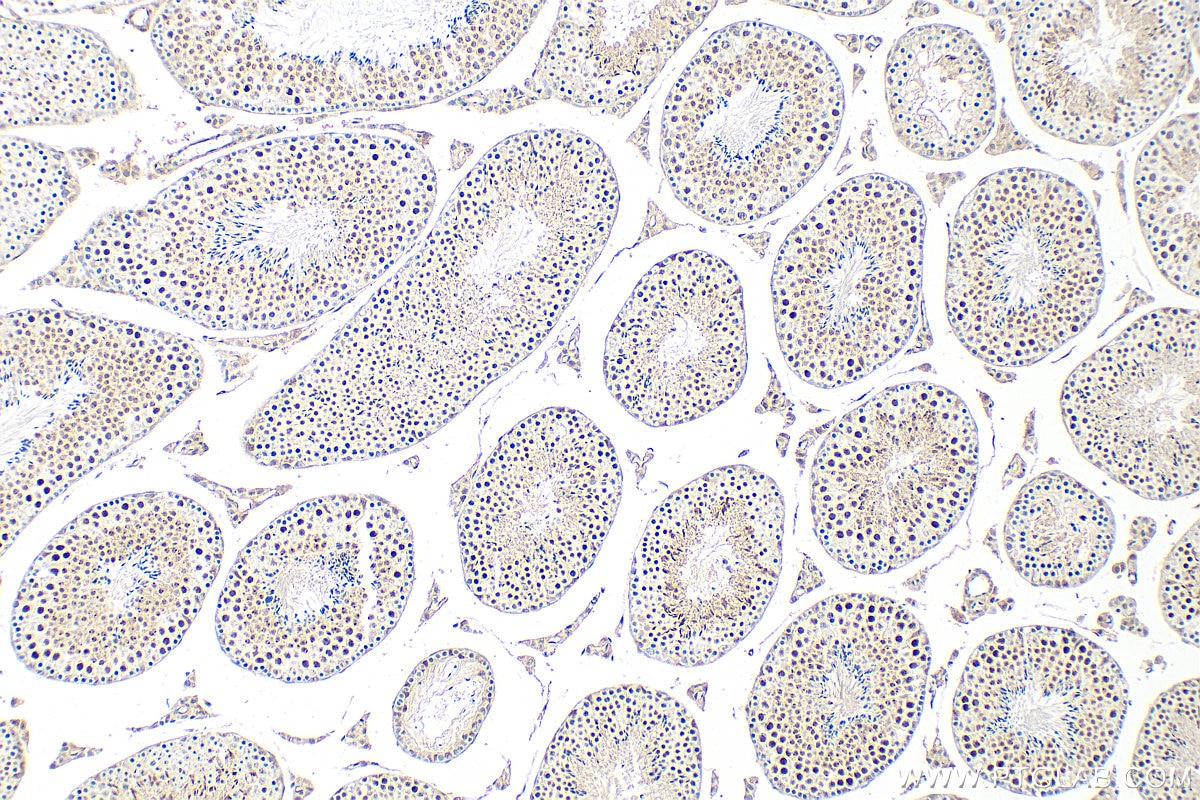 IHC staining of mouse testis using 23005-1-AP Immunohistochemistry (IHC) staining of mouse testis tissue using CENPV Polyclonal antibody (23005-1-AP)