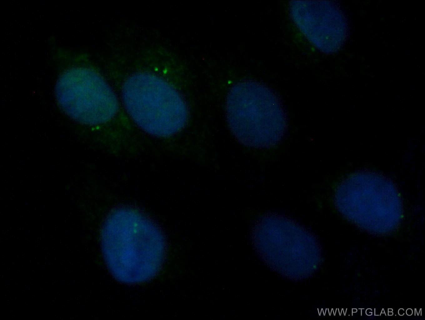 Immunofluorescence (IF) / fluorescent staining of MDCK cells using CEP110 Polyclonal antibody (25235-1-AP)