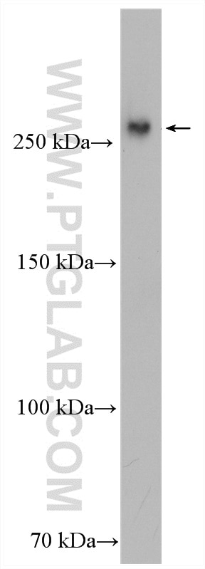 Western Blot (WB) analysis of Jurkat cells using CEP110 Polyclonal antibody (25235-1-AP)