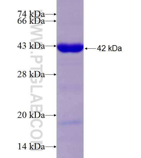CEP110 fusion protein Ag18907 SDS-PAGE
