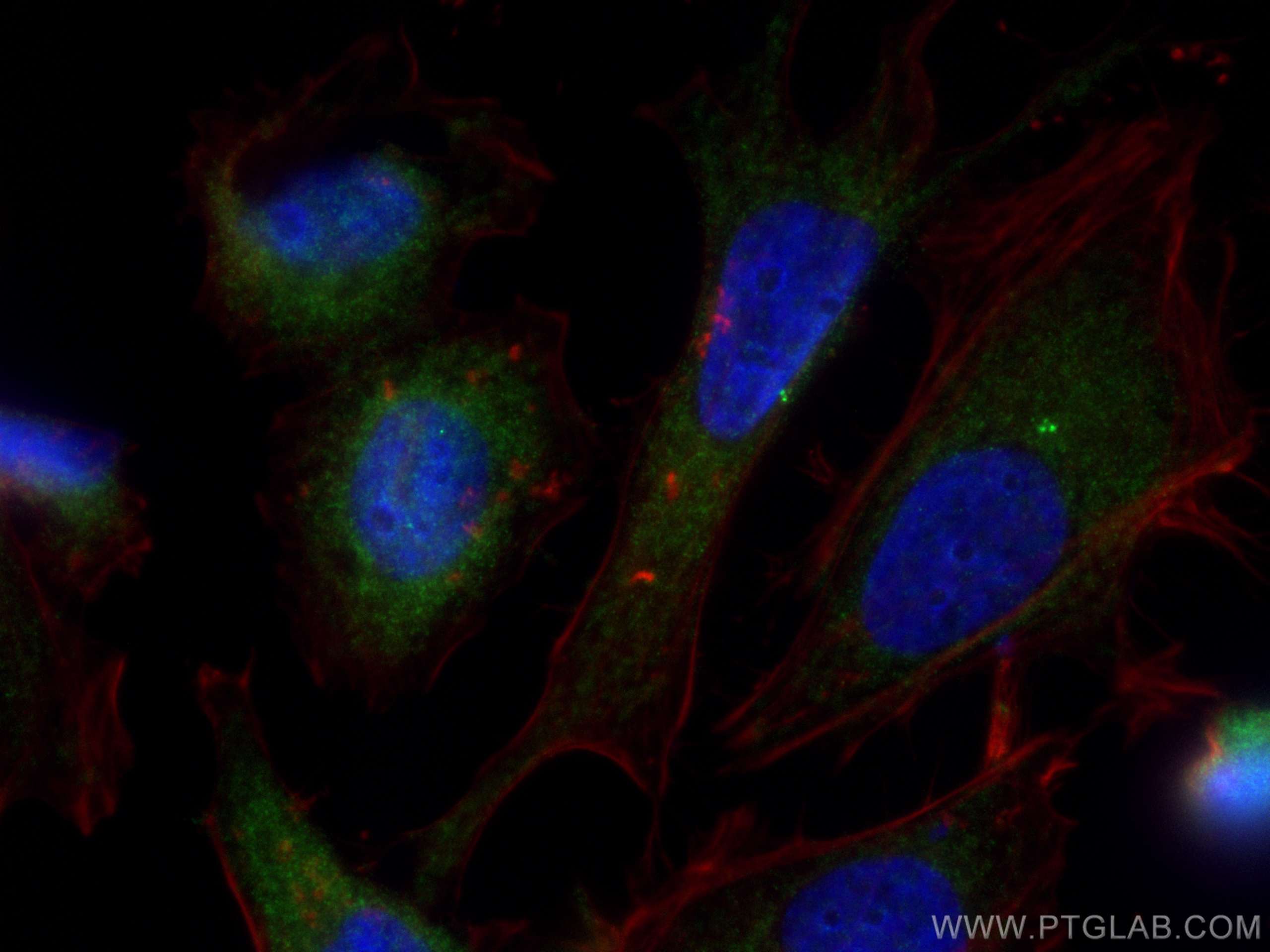 Immunofluorescence (IF) / fluorescent staining of HeLa cells using CEP120 Polyclonal antibody (24067-1-AP)