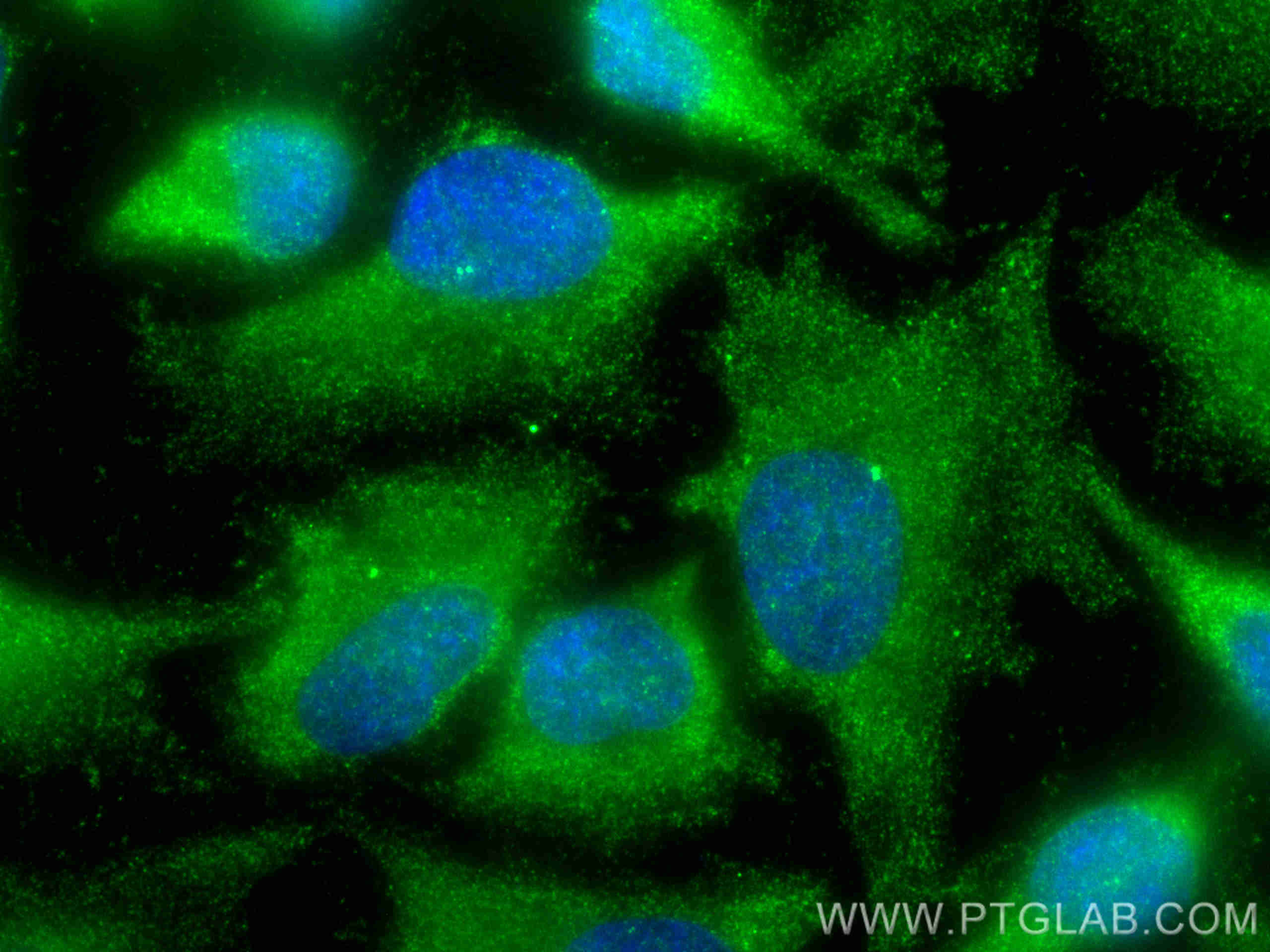 Immunofluorescence (IF) / fluorescent staining of HeLa cells using CEP120 Polyclonal antibody (24067-1-AP)