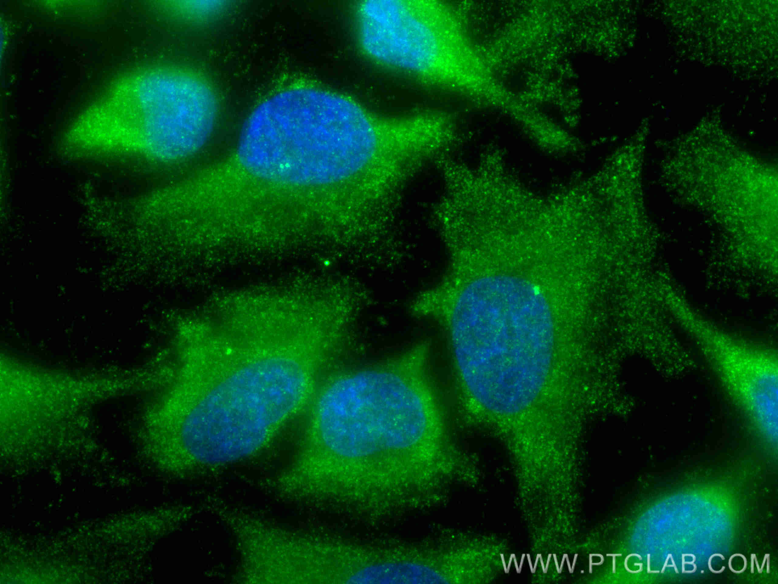 IF Staining of HeLa using 24067-1-AP