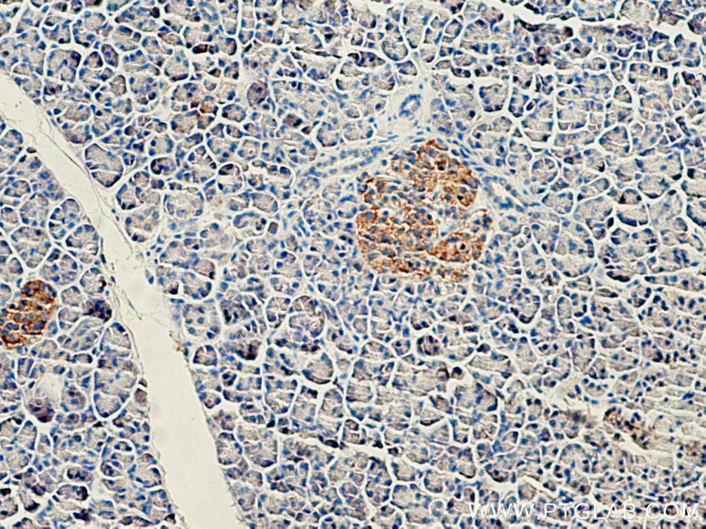 Immunohistochemistry (IHC) staining of human pancreas tissue using CEP120 Polyclonal antibody (24067-1-AP)