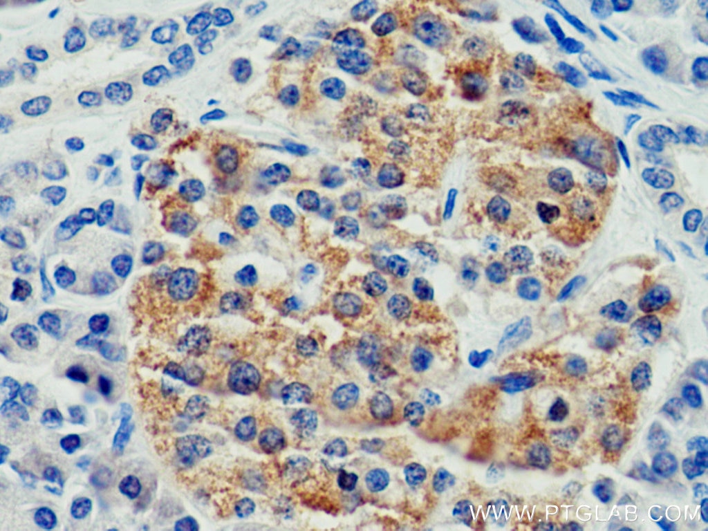 Immunohistochemistry (IHC) staining of human pancreas tissue using CEP120 Polyclonal antibody (24067-1-AP)