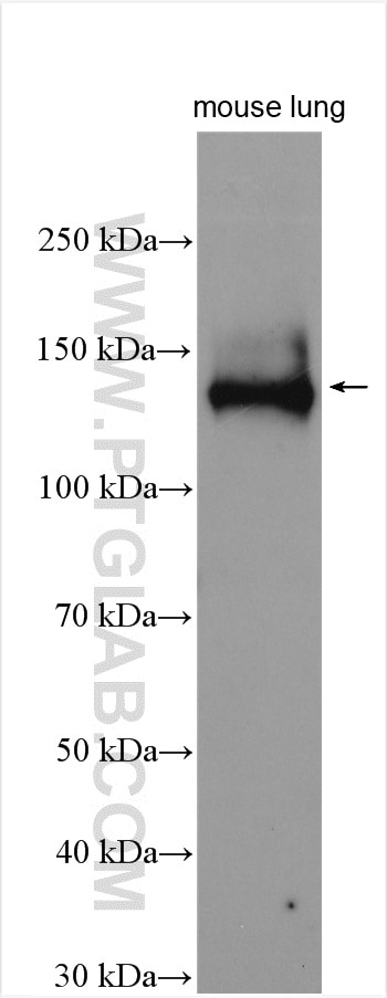 Western Blot (WB) analysis of mouse lung tissue using CEP120 Polyclonal antibody (24067-1-AP)
