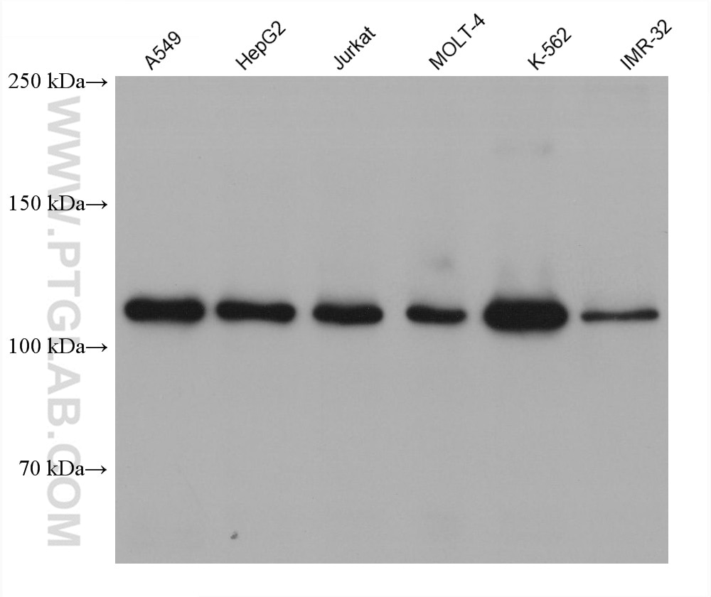 Western Blot (WB) analysis of various lysates using CEP120 Monoclonal antibody (60468-1-Ig)