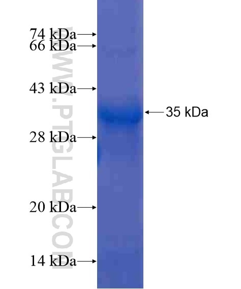 CEP120 fusion protein Ag21165 SDS-PAGE