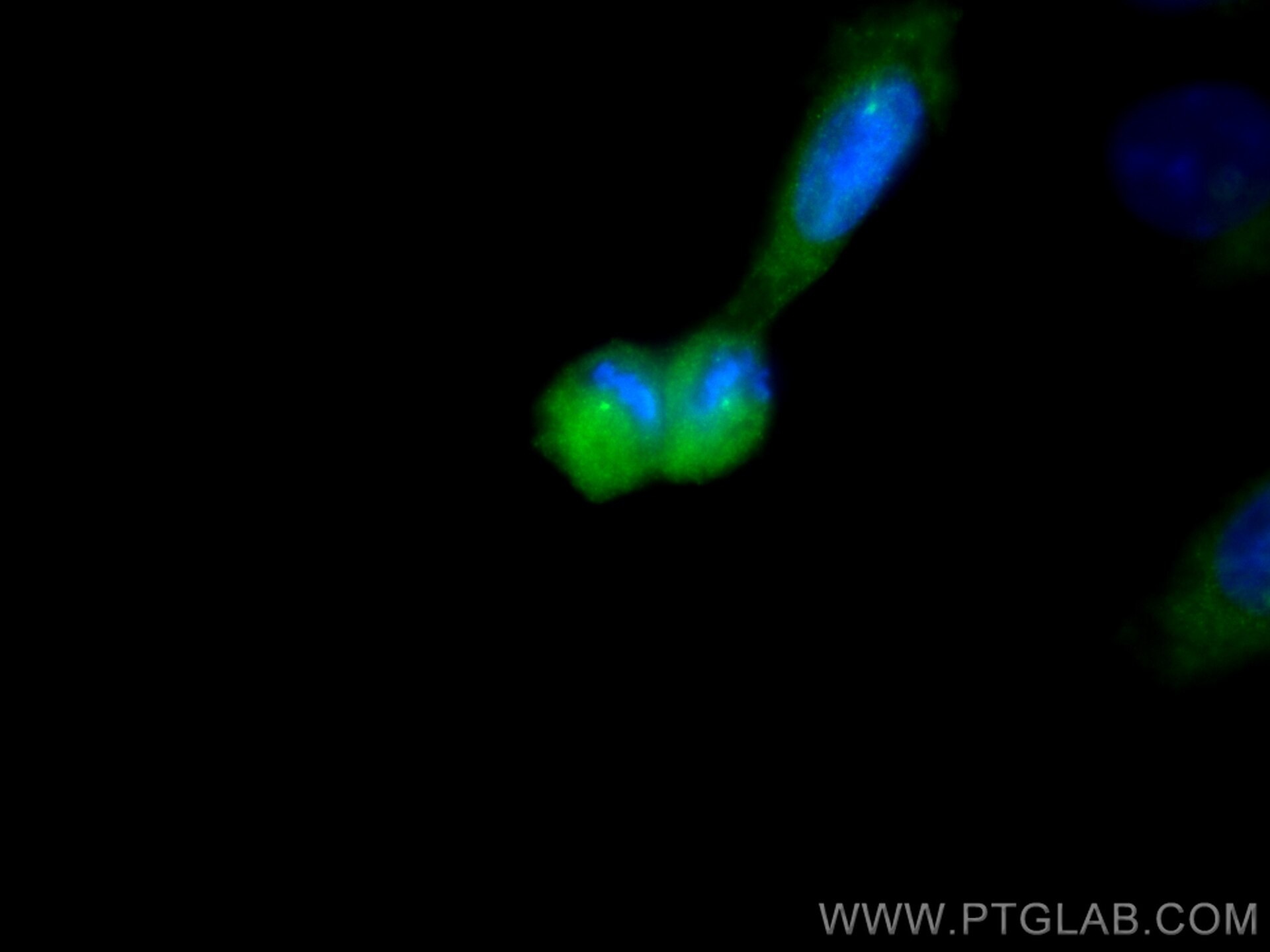 Immunofluorescence (IF) / fluorescent staining of U2OS cells using CEP128 Polyclonal antibody (24810-1-AP)