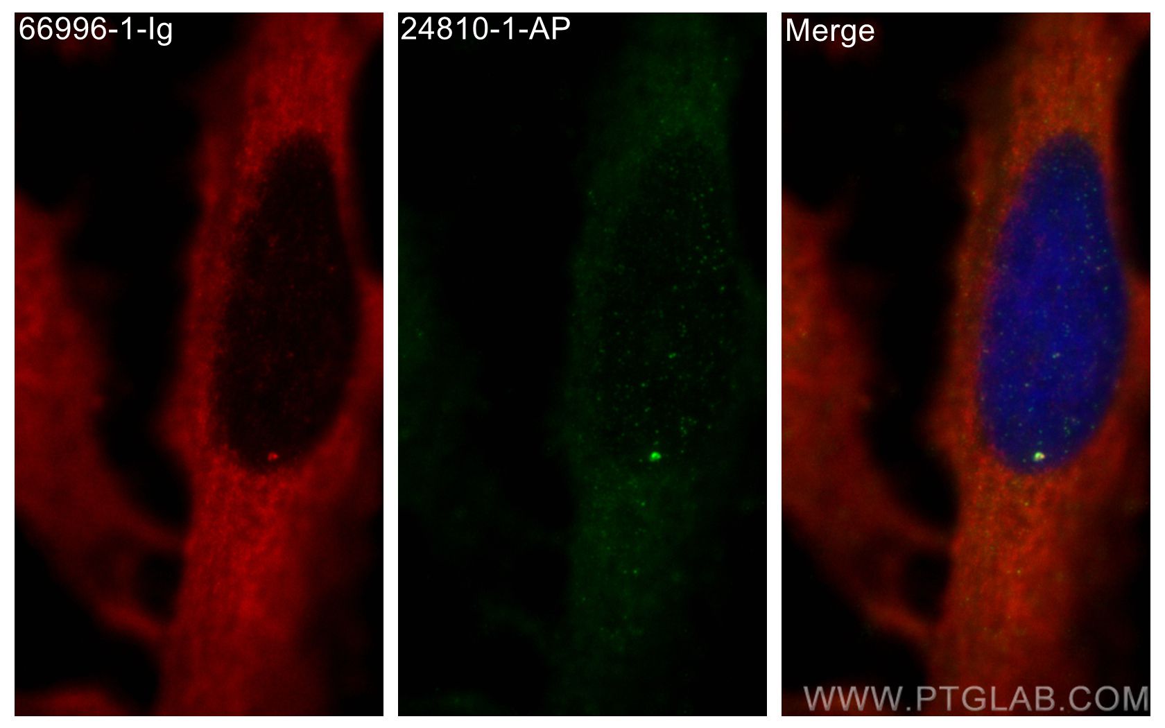 IF Staining of HeLa using 24810-1-AP